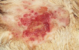 dermatite pyotraumatique